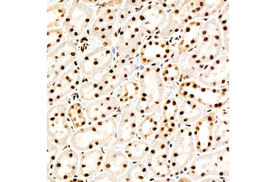 Immunohistochemistry - Anti-PERK (Phospho T982) Antibody [ARC58933] (A329734) - Antibodies.com