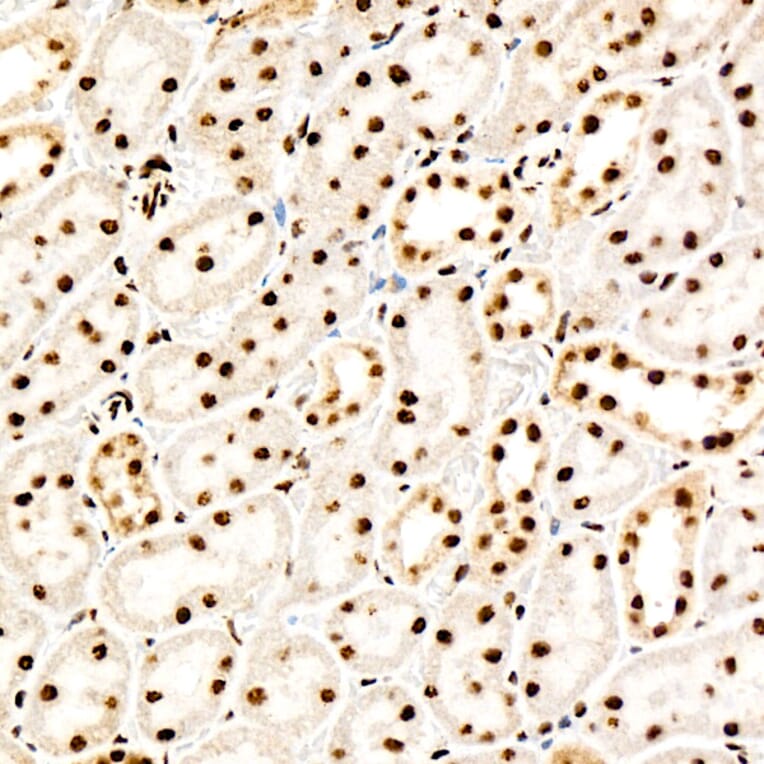Immunohistochemistry - Anti-PERK (Phospho T982) Antibody [ARC58933] (A329734) - Antibodies.com