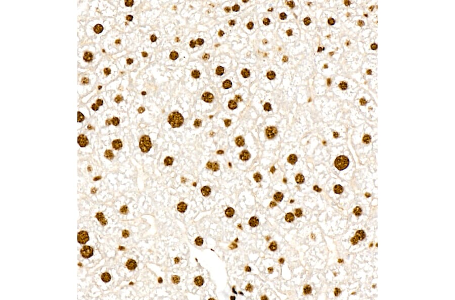 Immunohistochemistry - Anti-PERK (Phospho T982) Antibody [ARC58933] (A329734) - Antibodies.com