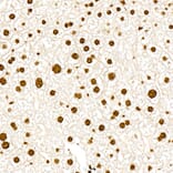 Immunohistochemistry - Anti-PERK (Phospho T982) Antibody [ARC58933] (A329734) - Antibodies.com
