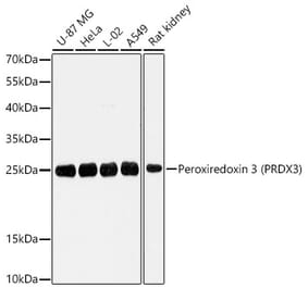 Western Blot - Anti-PRDX3 Antibody (A329735) - Antibodies.com