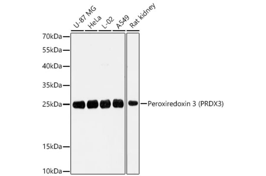 Western Blot - Anti-PRDX3 Antibody (A329735) - Antibodies.com