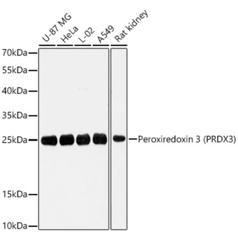 Western Blot - Anti-PRDX3 Antibody (A329735) - Antibodies.com