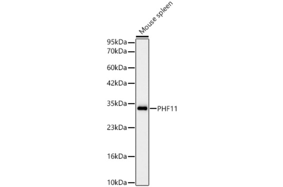 Western Blot - Anti-PHF11 Antibody [ARC62550] (A329740) - Antibodies.com