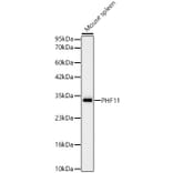 Western Blot - Anti-PHF11 Antibody [ARC62550] (A329740) - Antibodies.com