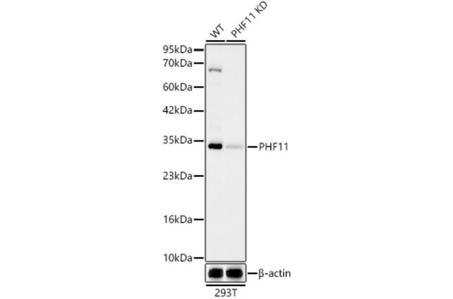 Western Blot - Anti-PHF11 Antibody [ARC62550] (A329740) - Antibodies.com