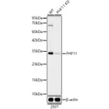 Western Blot - Anti-PHF11 Antibody [ARC62550] (A329740) - Antibodies.com