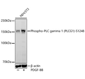 Western Blot - Anti-PLC-gamma-1 (Phospho S1248) Antibody [ARC64848] (A329741) - Antibodies.com