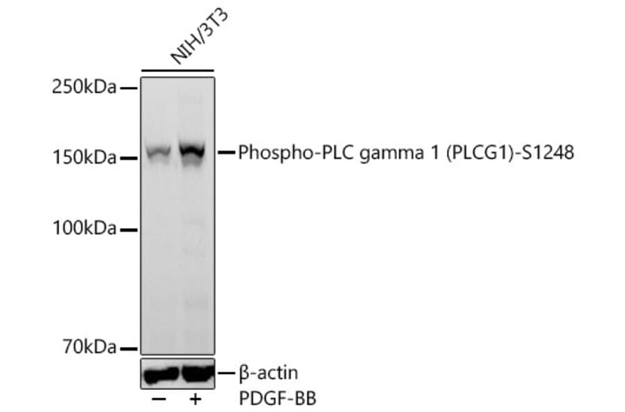 Western Blot - Anti-PLC-gamma-1 (Phospho S1248) Antibody [ARC64848] (A329741) - Antibodies.com