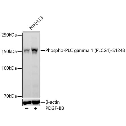 Western Blot - Anti-PLC-gamma-1 (Phospho S1248) Antibody [ARC64848] (A329741) - Antibodies.com