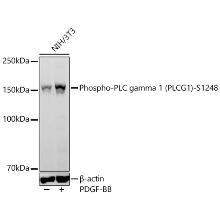 Western Blot - Anti-PLC-gamma-1 (Phospho S1248) Antibody [ARC64848] (A329741) - Antibodies.com
