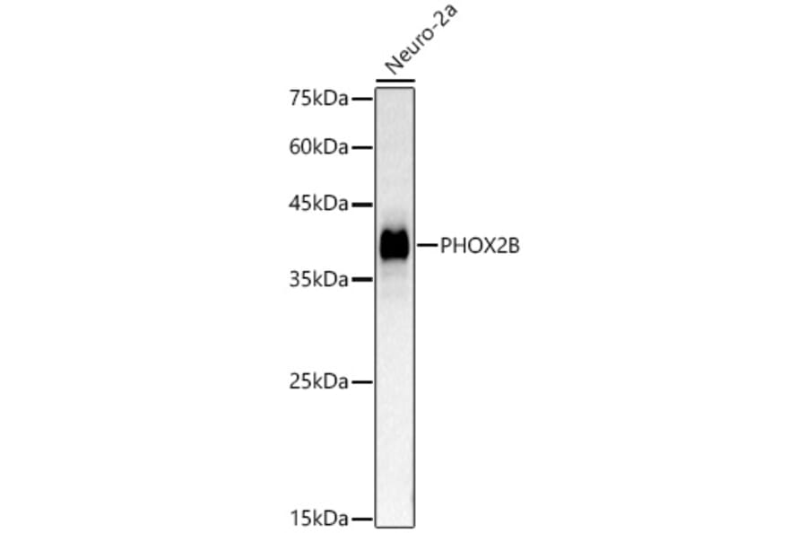 Western Blot - Anti-PHOX2B Antibody (A329742) - Antibodies.com