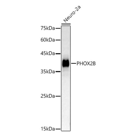 Western Blot - Anti-PHOX2B Antibody (A329742) - Antibodies.com