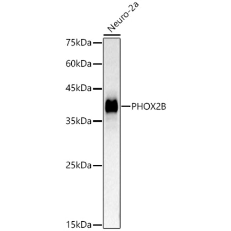 Western Blot - Anti-PHOX2B Antibody (A329742) - Antibodies.com