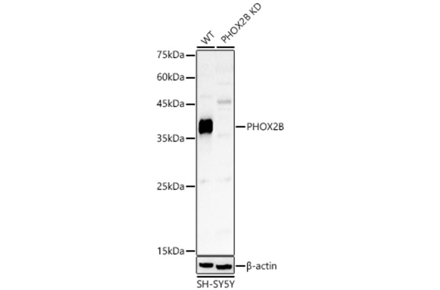 Western Blot - Anti-PHOX2B Antibody (A329742) - Antibodies.com