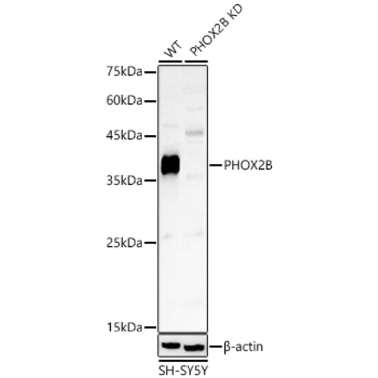 Western Blot - Anti-PHOX2B Antibody (A329742) - Antibodies.com