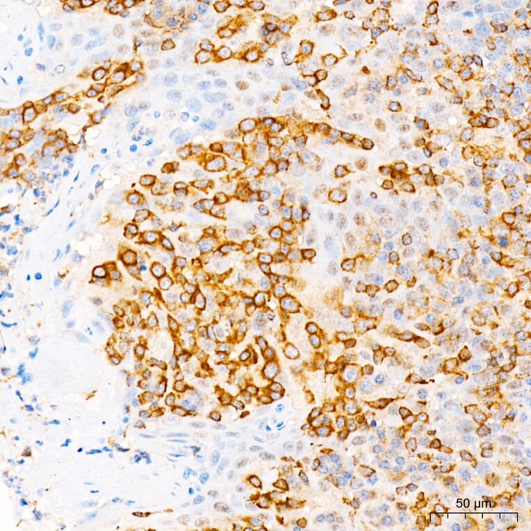 Immunohistochemistry - Anti-PI3K-gamma Antibody (A329743) - Antibodies.com