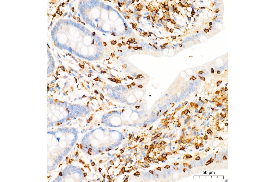 Immunohistochemistry - Anti-PI3K-gamma Antibody (A329743) - Antibodies.com