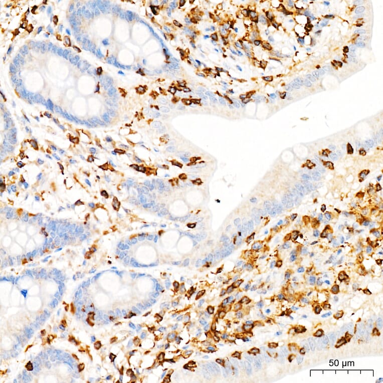 Immunohistochemistry - Anti-PI3K-gamma Antibody (A329743) - Antibodies.com