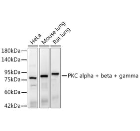 Western Blot - Anti-PKC alpha + beta + gamma Antibody [ARC3211] (A329748) - Antibodies.com