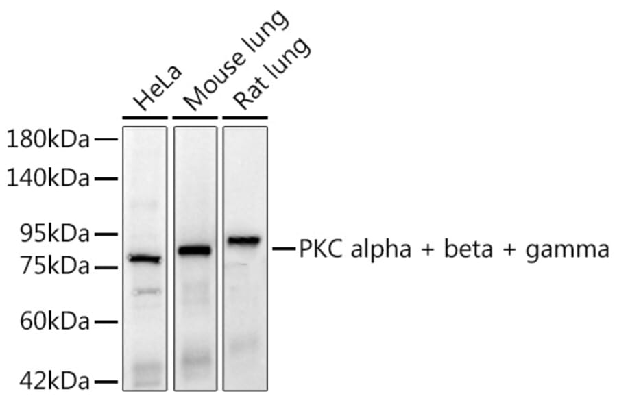 Western Blot - Anti-PKC alpha + beta + gamma Antibody [ARC3211] (A329748) - Antibodies.com