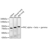 Western Blot - Anti-PKC alpha + beta + gamma Antibody [ARC3211] (A329748) - Antibodies.com
