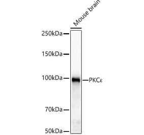Western Blot - Anti-PKC epsilon Antibody [ARC61191] (A329750) - Antibodies.com