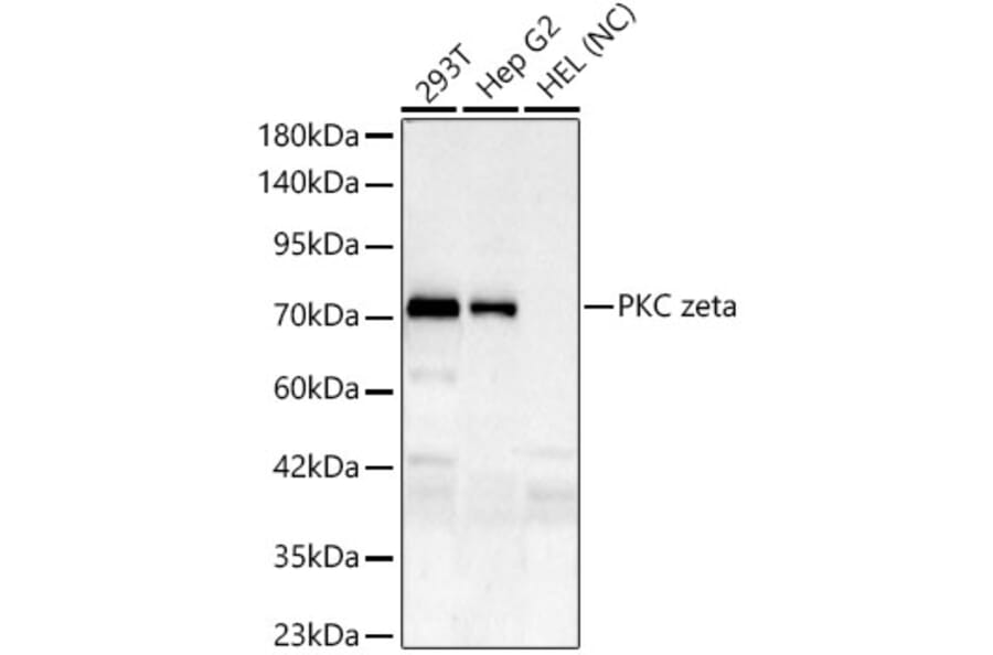 Western Blot - Anti-PKC zeta Antibody [ARC61755] (A329751) - Antibodies.com