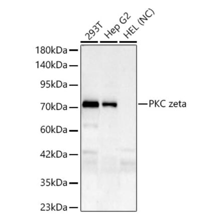 Western Blot - Anti-PKC zeta Antibody [ARC61755] (A329751) - Antibodies.com