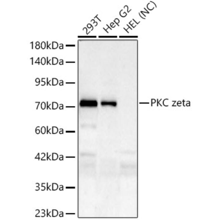 Western Blot - Anti-PKC zeta Antibody [ARC61755] (A329751) - Antibodies.com