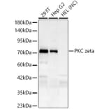 Western Blot - Anti-PKC zeta Antibody [ARC61755] (A329751) - Antibodies.com