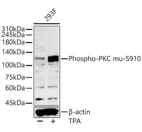 Western Blot - Anti-PKD (Phospho S910) Antibody (A329752) - Antibodies.com