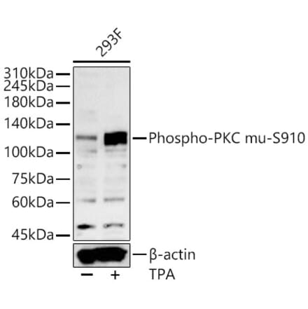 Western Blot - Anti-PKD (Phospho S910) Antibody (A329752) - Antibodies.com