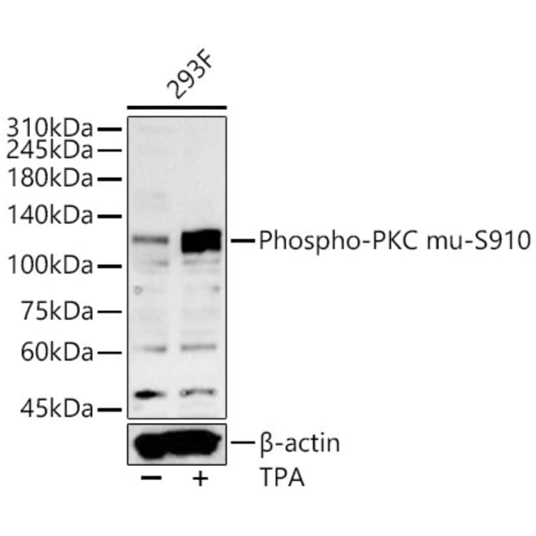Western Blot - Anti-PKD (Phospho S910) Antibody (A329752) - Antibodies.com