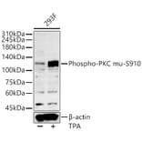 Western Blot - Anti-PKD (Phospho S910) Antibody (A329752) - Antibodies.com