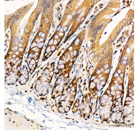 Immunohistochemistry - Anti-PKR Antibody (A329753) - Antibodies.com