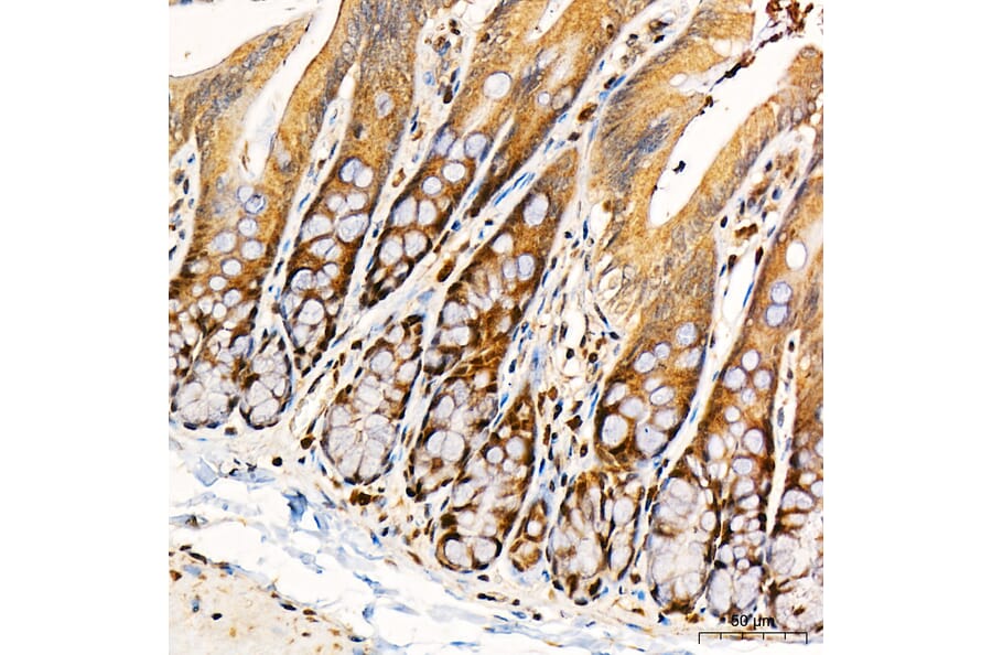 Immunohistochemistry - Anti-PKR Antibody (A329753) - Antibodies.com