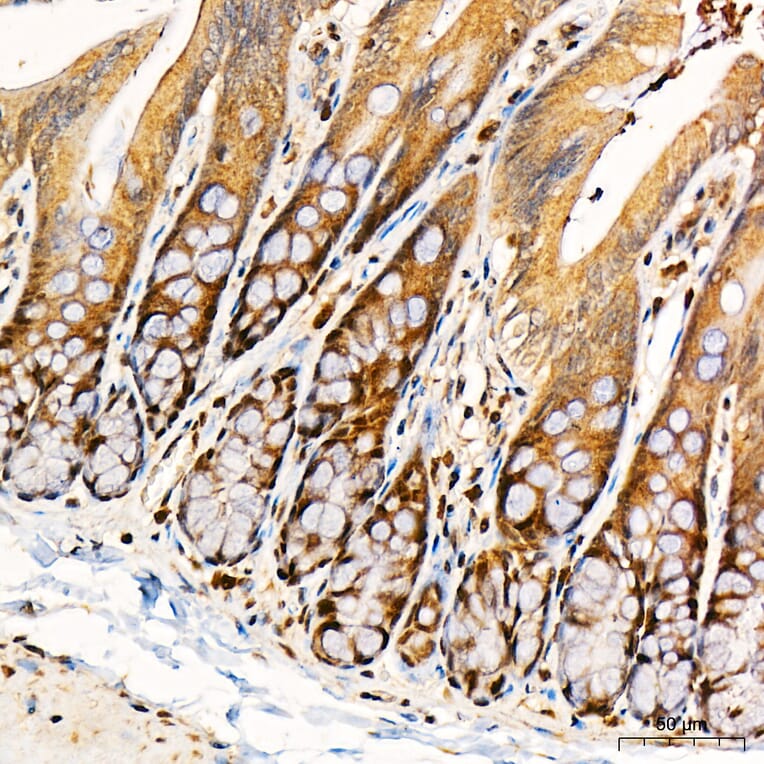 Immunohistochemistry - Anti-PKR Antibody (A329753) - Antibodies.com