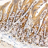 Immunohistochemistry - Anti-PKR Antibody (A329753) - Antibodies.com