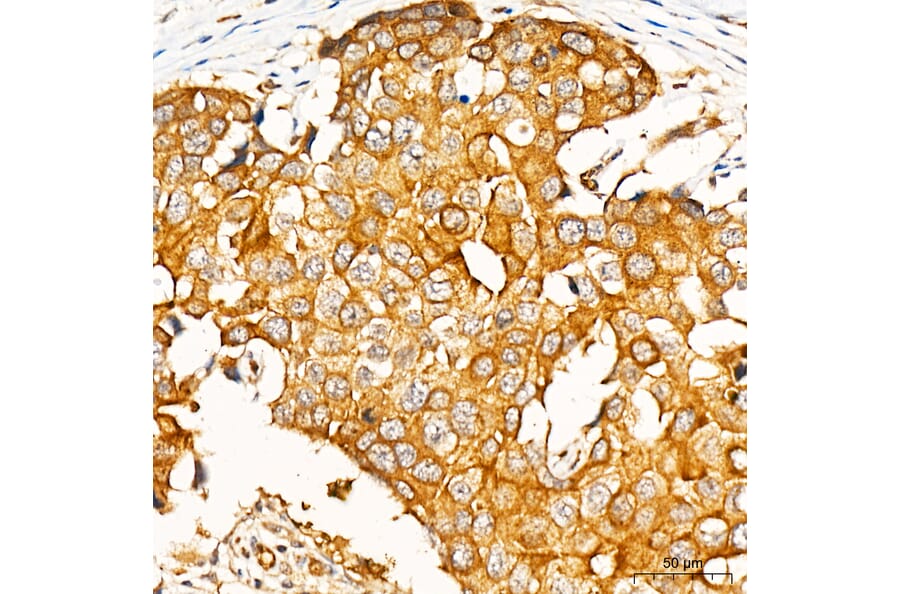 Immunohistochemistry - Anti-PKR Antibody (A329753) - Antibodies.com