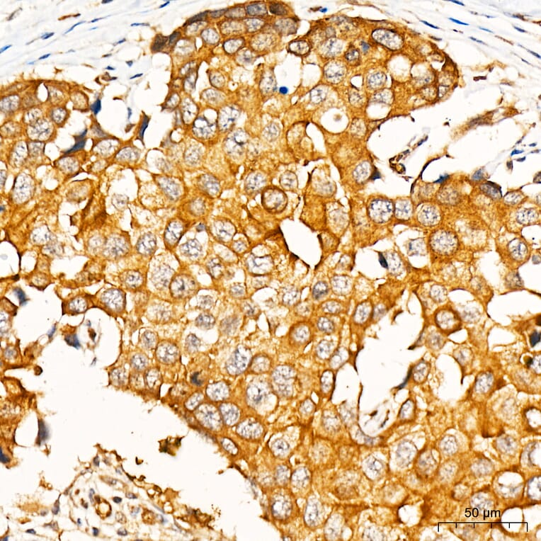 Immunohistochemistry - Anti-PKR Antibody (A329753) - Antibodies.com