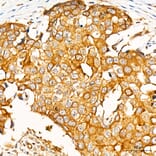 Immunohistochemistry - Anti-PKR Antibody (A329753) - Antibodies.com