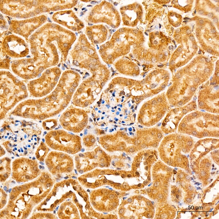 Immunohistochemistry - Anti-PKR Antibody (A329753) - Antibodies.com