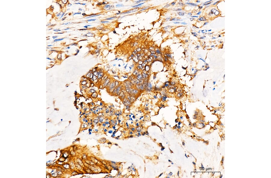 Immunohistochemistry - Anti-PKR Antibody (A329753) - Antibodies.com