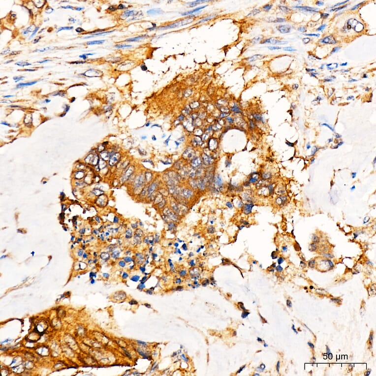 Immunohistochemistry - Anti-PKR Antibody (A329753) - Antibodies.com