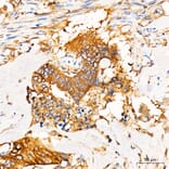 Immunohistochemistry - Anti-PKR Antibody (A329753) - Antibodies.com