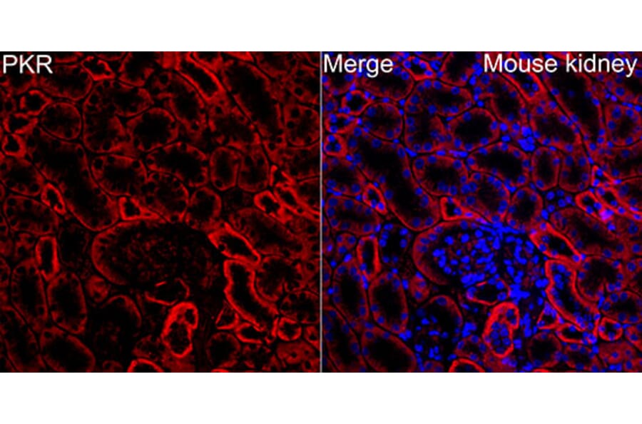 Immunofluorescence - Anti-PKR Antibody (A329753) - Antibodies.com