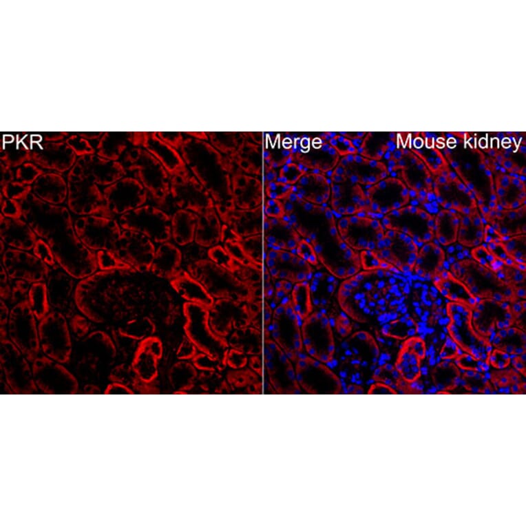 Immunofluorescence - Anti-PKR Antibody (A329753) - Antibodies.com