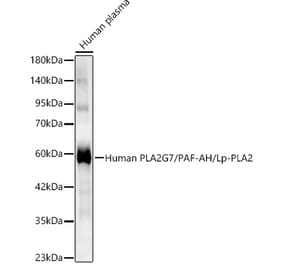 Western Blot - Anti-PLA2G7 Antibody (A329754) - Antibodies.com