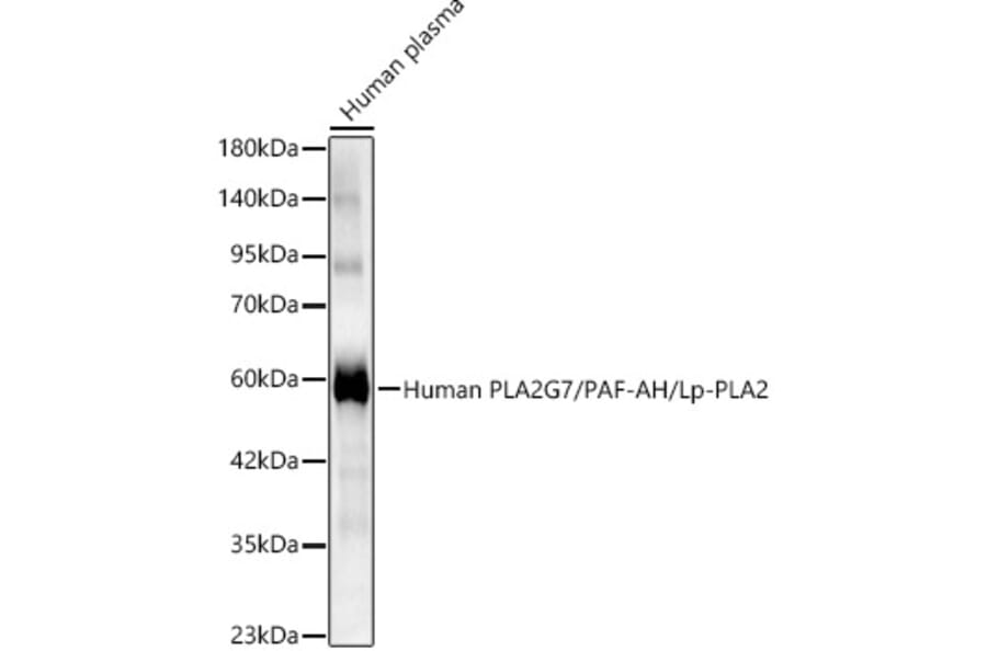 Western Blot - Anti-PLA2G7 Antibody (A329754) - Antibodies.com